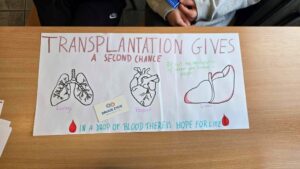 Transplantacja na językach (7)